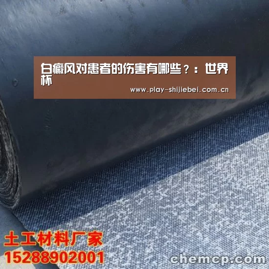 白癜风对患者的伤害有哪些?:世界杯(图3) 世界杯直播